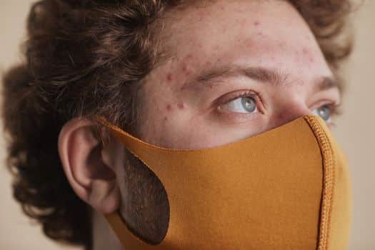 Detailed close-up of a man wearing a face mask, highlighting his acne and blue eyes.